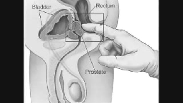 best of Prostate solo