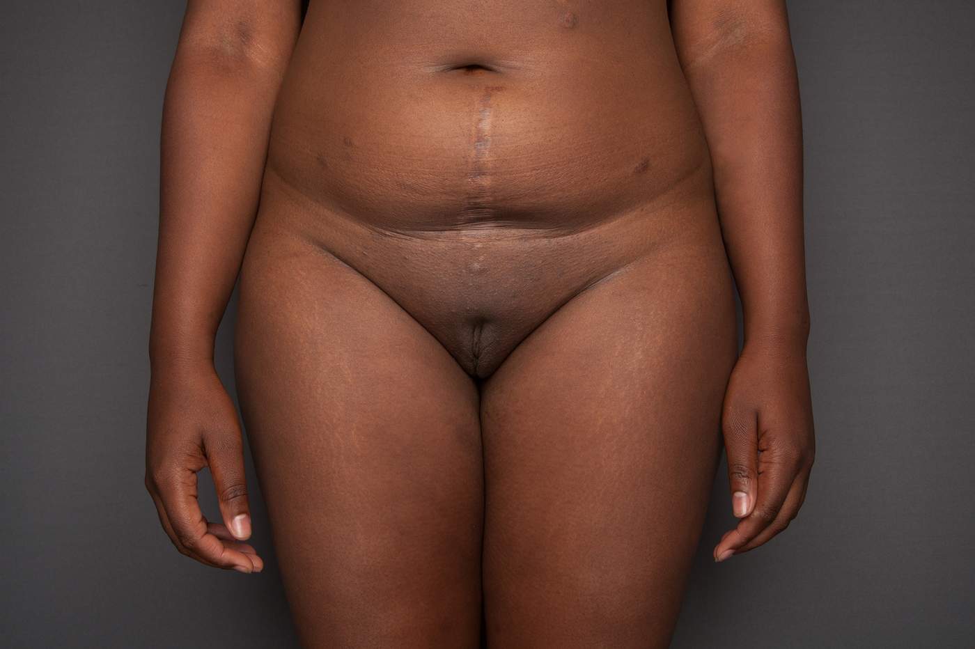 Female vulva labia photos