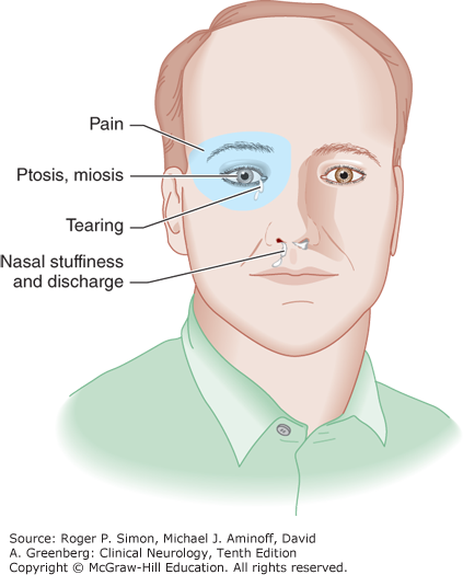 Facial pain behind cheekbone