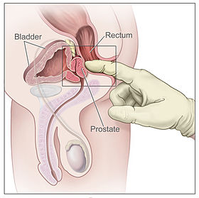 Saber reccomend Trou prostate anus