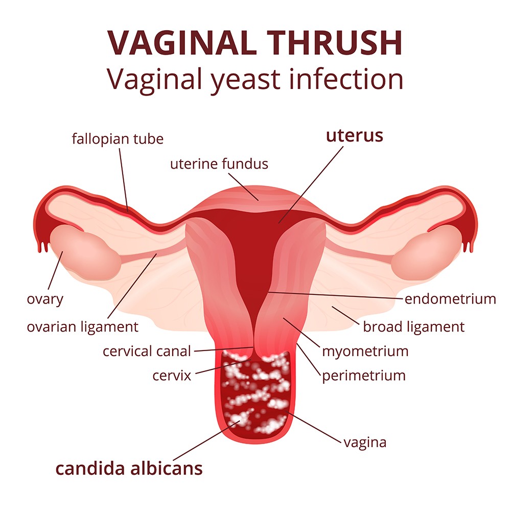 best of Of symtoms vagina irritation Burning