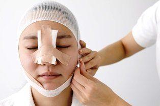 best of Settlements for facial scar Insurance