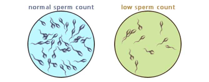 best of Count Very low sperm