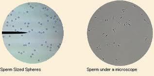 Vasectimy sperm test