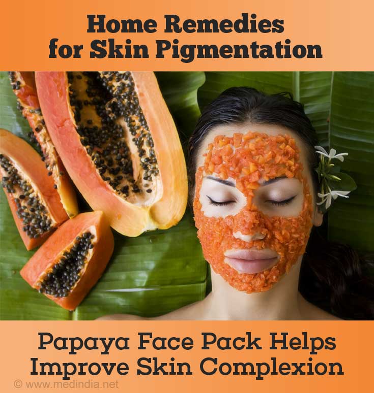 Facial discoloration treatment home remedy
