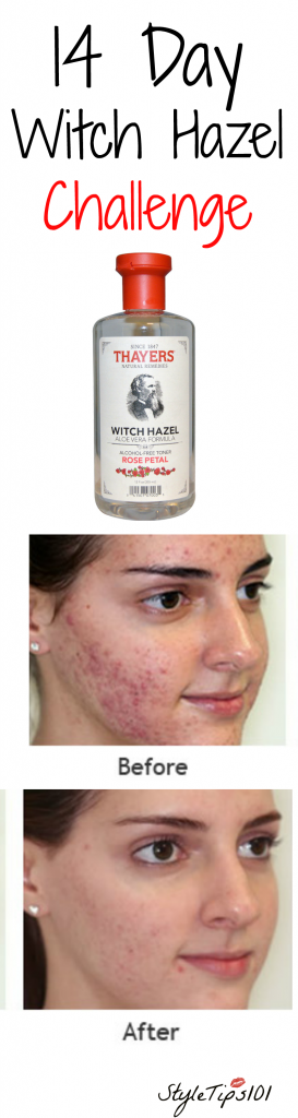 The E. Q. reccomend Facial sweating witch hazel