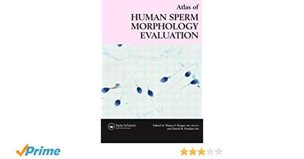 best of Evaluation human morphology sperm Atlas