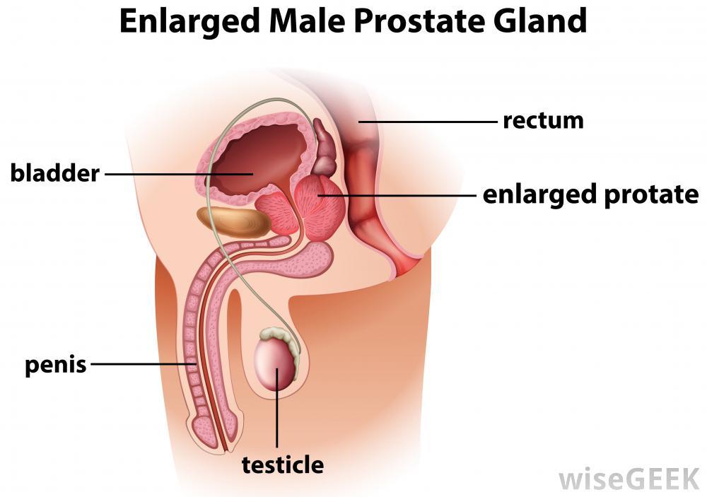 Dew D. reccomend Male orgasm prostate