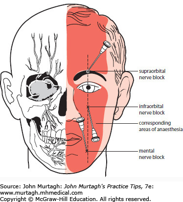Facial artery and anaesthesia