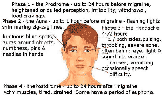 Facial numbness syndrome