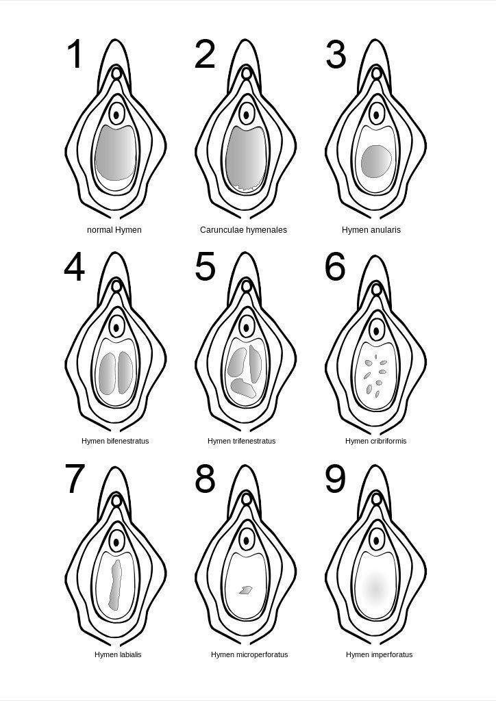 Dino reccomend Diagram of virgin vagina