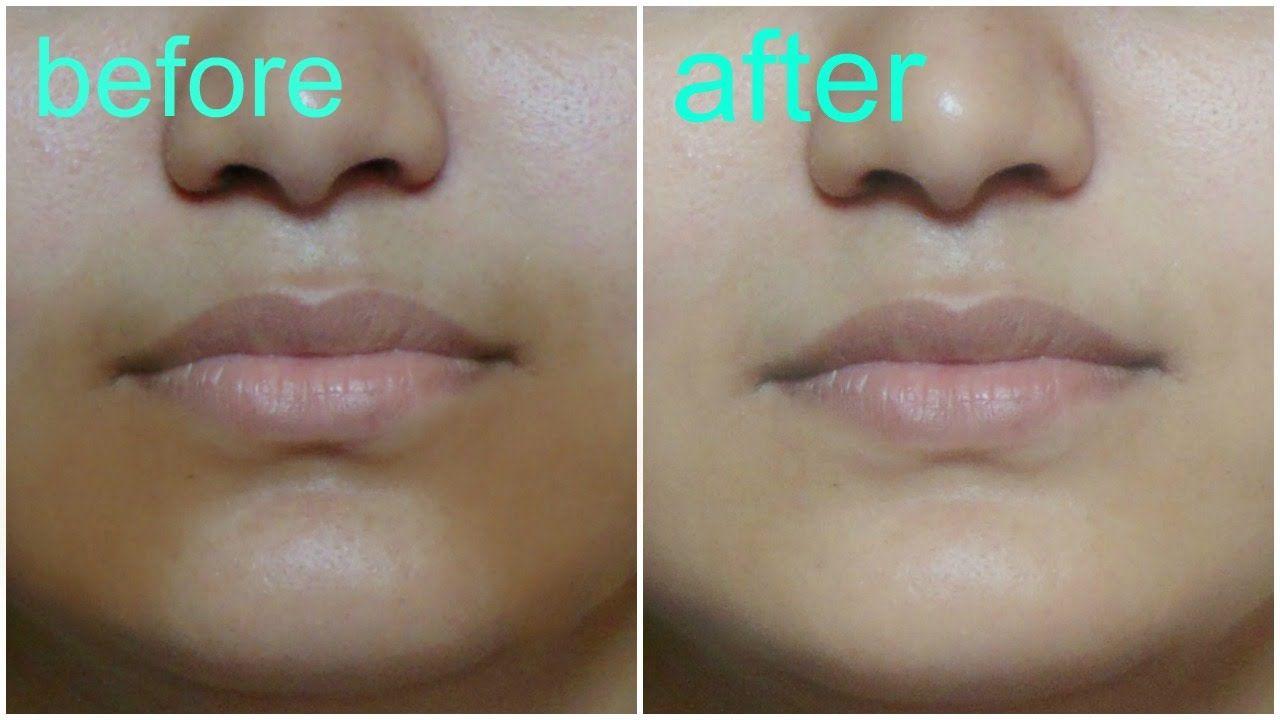 best of Home Facial discoloration remedy treatment