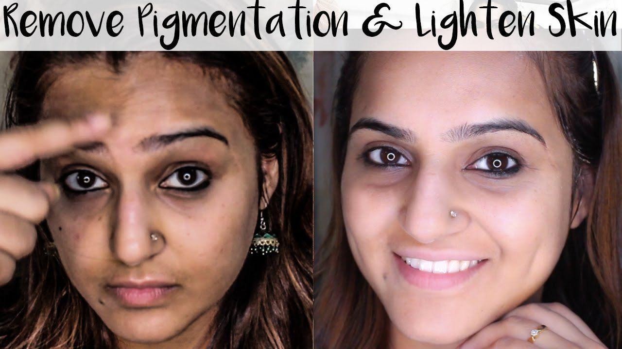Facial discoloration treatment home remedy
