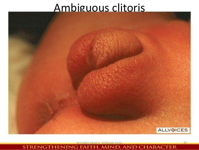 best of Condition clitoris Medical potruding