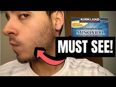 Evil E. reccomend Minoxidil facial hair growth