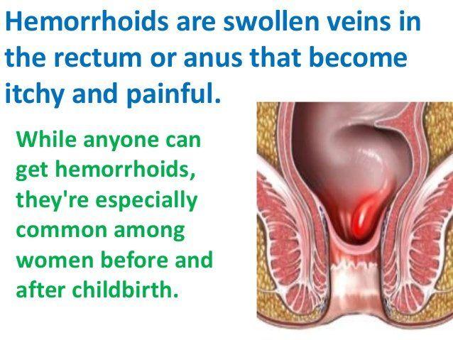 Swelling of anus